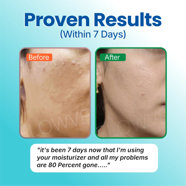 Before and after photo from a customer using Soft Reset for seven days, showing calmer skin with fewer marks on the cheek